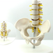 PELVIS06 (12343) Halbe Life-Größe Becken mit 5pcs Lendenwirbelsäule Anatomie Modell, Lumber Vertebrae Modell